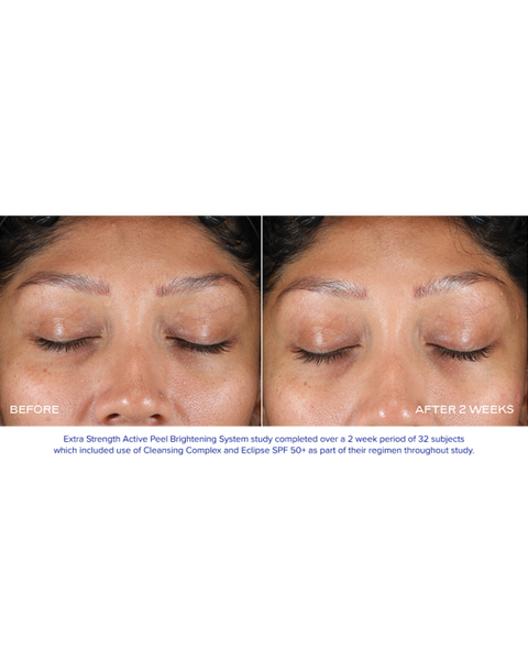 EXTRA STRENGTH ACTIVE PEEL BRIGHTENING SYSTEM